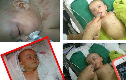 جزئیات شکنجه یک نوزاد در رشت