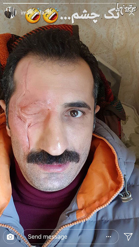 عکس/ گریم ناخوشانید آقای بازیگر!