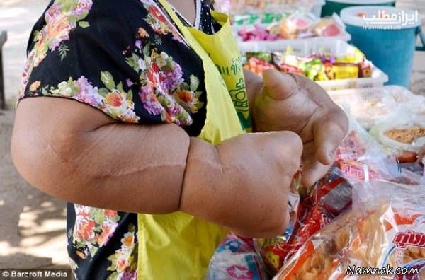 دستان غول پیکر و عجیب یک زن+عکس
