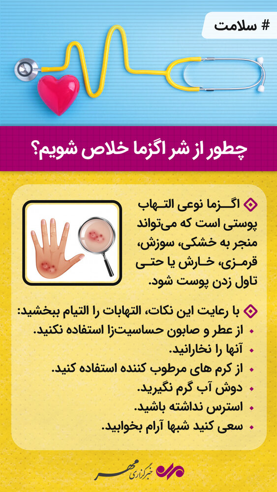 چگونه از شر اگزما خلاص شویم؟