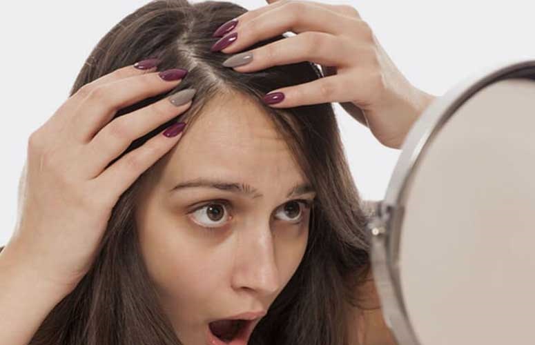 ریزش مو؛ نشانه جدید کرونا!؟ ریزش مو؛ نشانه جدید کرونا!؟