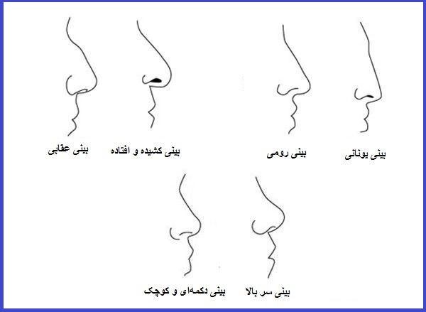 بهترین فرم بینی برای صورت من کدام است؟