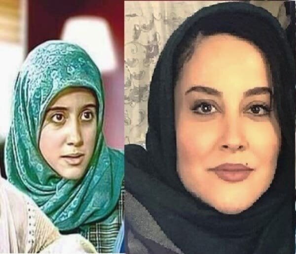 تفاوت عجیب چهره خانم بازیگر قبل از عمل جراحی تفاوت عجیب چهره خانم بازیگر قبل از عمل جراحی