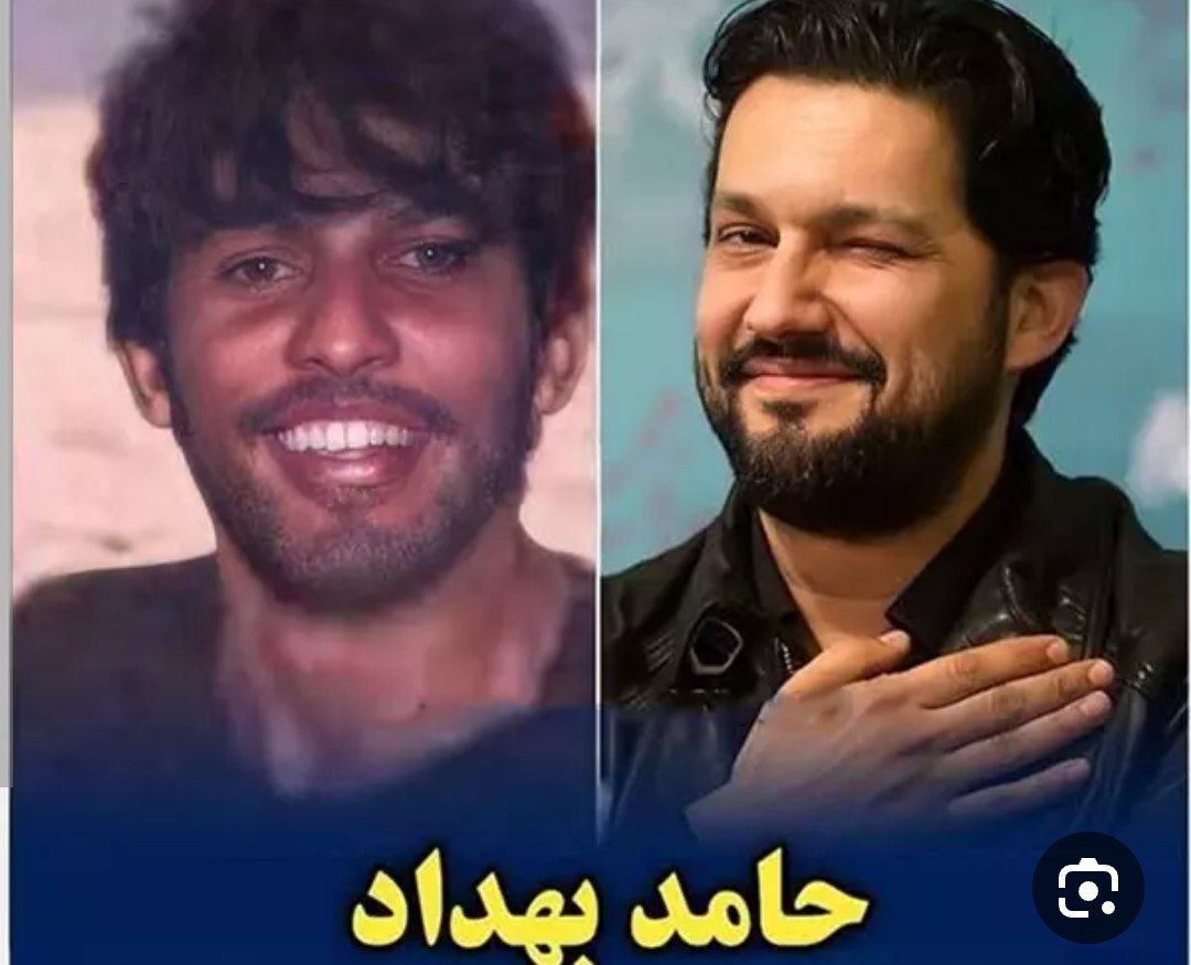 عکس قدیمی و لو رفته از حامد بهداد عکس قدیمی و لو رفته از حامد بهداد