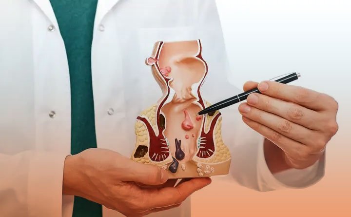 شایع‌ترین علائم بواسیر
